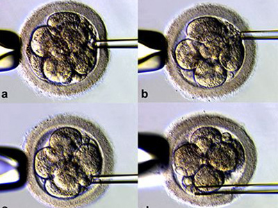囊胚,囊胚移植,试管婴儿,三代试管