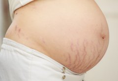 无痛分娩适合所有孕妇吗？
