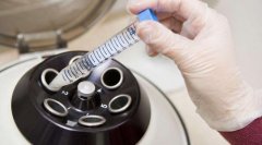 HIV携带者可以到俄罗斯做第三代试管婴儿吗？