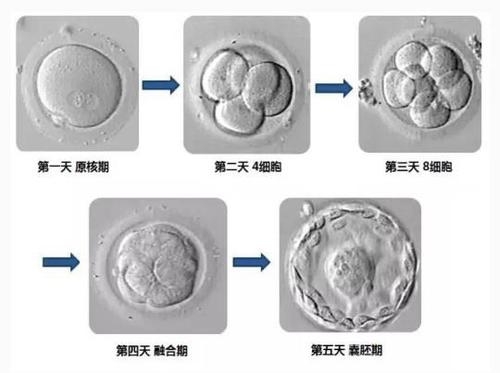 试管婴儿,囊胚等级,胚胎,受精卵