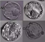 胚胎移植3选1，到底应该怎么选？
