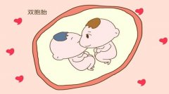 试管婴儿移植两个胚胎就可以生双胞胎吗