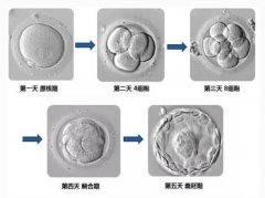 俄罗斯第三代试管婴儿胚胎培育的过程