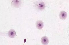男性精子DNA碎片率高会影响胚胎发育