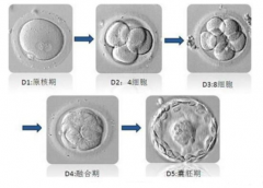 俄罗斯试管婴儿中养囊的作用和重要性