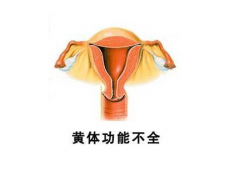 为什么女性黄体功能不全会导致不孕