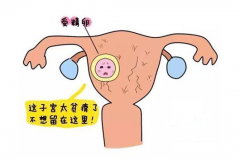 为什么做试管婴儿也容易发生宫外孕