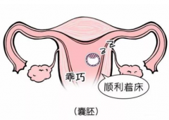 俄罗斯第三代试管婴儿移植后可以同房吗