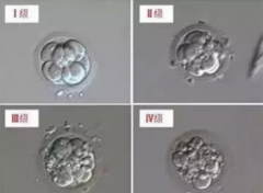 试管婴儿中胚胎碎片多是什么原因 要如何预防和