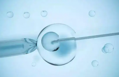 做试管婴儿的条件涉及到哪些？