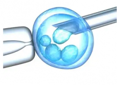 俄罗斯第三代试管技术PGD、PGS、NGS的区别