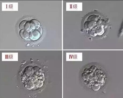 试管婴儿