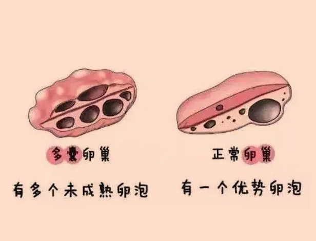 试管婴儿技术，俄罗斯试管婴儿
