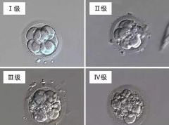 试管婴儿胚胎冷冻等级