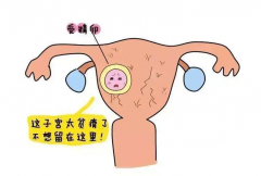 试管婴儿子宫外孕：注意妇女生育健康