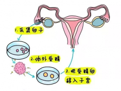 俄罗斯试管婴儿人工周期